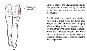 Check spelling or type a new query. Hip Dysplasia And Everyday Life International Hip Dysplasia Institute