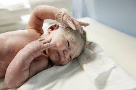 It is derived from the latin word 'lana which means wool. Is Your Newborn S Appearance Normal Lisa Lewis Md
