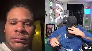 Fanum does a face reveal just hours after getting a bad allergic reaction  😭👏