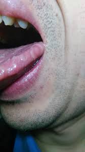 舌苔藓白色,白色- 伤感说说吧