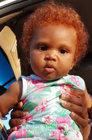 30 Beautiful Genetic Mutations In Humans Geneticmutations Genes Stunning Uniquelooks Uniquepeople Red Hair Don T Care Genetic Mutation Beautiful Children