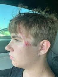 Teenager Saves Drowning Child at Scissortail Park