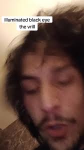 Peter Brabeck Letmathe Black Eye