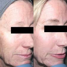 Charlene Tracy, Janice, DO, 9552 E Conquistadores Dr, Scottsdale, AZ 85255,  US