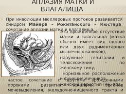 Check spelling or type a new query. Lekciya Anomalii Razvitiya Zhenskoj Polovoj Sistemy