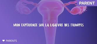 Elle a donc entrepris les démarches pour se faire ligaturer les trompes, à 28 ans, en étant nullipare. La Ligature Des Trompes Mon Experience Lifebygirls