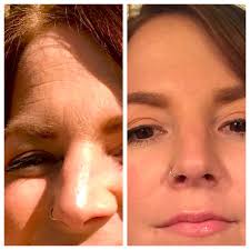 TOP 10 BEST Medical Spas near Matthews, NC