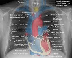 Anatomy of the chest cavity. Anatomy For Radiology Chest Glass Box