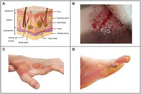 Image result for Skin Trauma