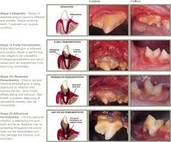 According to the american veterinary dental society, an astounding 70 percent of cats show signs of the risk of kidney disease was found to be significantly higher in cats with any stage of periodontal disease than in control cats. Dental Disease 3 Pet Care Dogs Pet Care Pet Dental Health Month