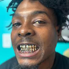 Superb craftsmanship. We are some of the best to do it. This guy has been a  loyal client over 10 years and has one of the hardest sets! It's the detail  and