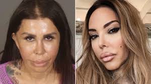 Boy, 11, with Special Needs Was 'Completely Dependent'