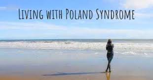 Celebrities With Poland Syndrome