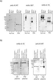 Martin cheah & associates is a lawyer firm located in kuala lumpur, kuala lumpur with 3 practicing lawyer. Ige Tailpiece Associates With A 1 Antitrypsin A1at To Protect Ige From Proteolysis Without Compromising Its Ability To Interact With Fceri Scientific Reports