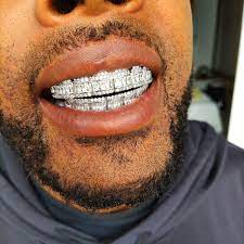 Diamond grillz on teeth