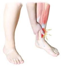 Whether Your Tibialis Anterior Tendonitis Is The Result Of Ongoing Strain Or A Sudden Injury We Know That You Tendonitis Treatment Tendinitis Ankle Tendonitis