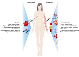 The doctor may also need to biopsy the lymph nodes under the arm to check them for cancer spread. Challenges And Achievements Of Liquid Biopsy Technologies Employed In Early Breast Cancer Ebiomedicine