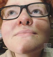 Allison Sharpe