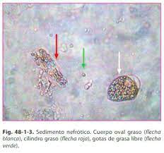 Pin De Liborio Escobedo En Renal Sedimentarias Flechas Flecha Roja