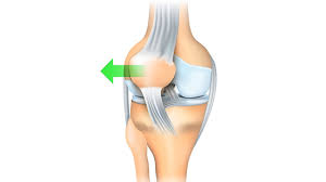 Image result for Patellar Apprehension Test