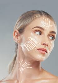 Trattamento ai fili di collagene