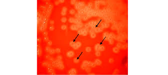 Image result for Group D Streptococcus