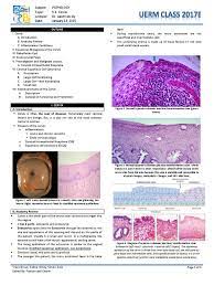 There are two types of cells that line the cervix, one lines the outer cervix (portio) and another lines the inner cervix (endocervix). Pathology 5 05a Cervix Cervical Cancer Medical