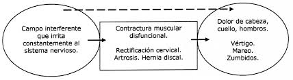 La manera más fácil de diagnosticarla es . Rectificacion Cervical Dolores Musculares Cervicales Mareo Vertigo Acufenos Zumbidos Tratamiento Argentina