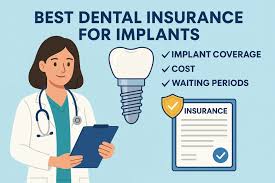 Best Dental Insurance for Implants: Top 9 Plans in 2025