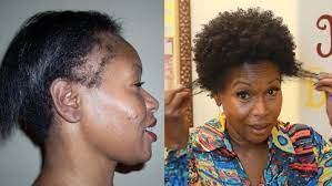 How I Repaired My Thinning Edges 2 Products Video Edges Hair Natural Hair Styles Hair Styles