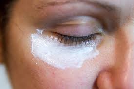 Harmless Small White Bumps Appearing Under The Eyes Or On The Eyelids Are Known As Milia They Are Tiny Skin Tag On Eyelid Homemade Wrinkle Cream Forehead Acne
