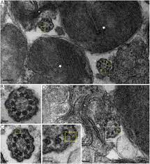 Kirjaudu facebookiin, niin voit alkaa jakaa ja jutella kavereillesi, perheenjäsenille ja tuntemillesi ihmisille. Superresolution Microscopy Reveals Photoreceptor Specific Subciliary Location And Function Of Cep290 Biorxiv