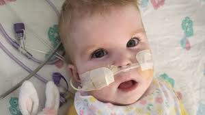 Muere Indi Gregory, bebé de 8 meses que padecía una enfermedad incurable:  los doctores la desconectaron