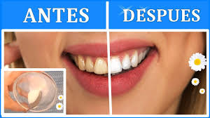 Tenemos la opción de blanquearnos los dientes de forma natural, los resultados son un poco más lentos, pero igualmente increíbles y baratos. Como Blanquear Los Dientes En Casa Remedio Eficaz Y Seguro Youtube
