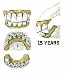 Horses Age From Teeth Growth Knowing The Signs Of Age