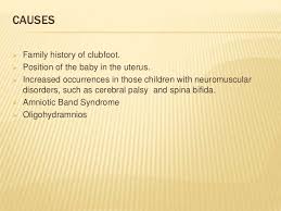 The causes of clubfoot in babies are not exactly clear. Physio Masud Club Foot Facebook