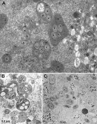 Transmission electron microscopy of oocytes of three tick species...