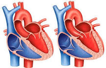 Image result for what is the cost of mitral valve treatment for cavapoo