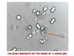 Http Renalcalculi Net Crystals In Urine Html Crystals In Urine Calcium Carbonate Crystals In Urine Medical Laboratory Science Urinal Crystals