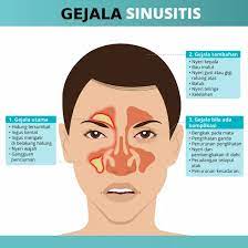 Hidung tersumbat sebelah bisa disebabkan oleh berbagai hal. Habbaco99 Nanogurah Obat Herbal Sakit Paru Paru Sesak Nafas Batuk Menahun Batuk Kering Sakit Tenggorokan Kapsul Gurah Paru Paru Flu Menahun Tbc Asma Bronchitis Pilek Polip Sinusitis Pnemonia Nafas Tersengal Ispa Infeksi Pernafasan