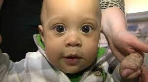 Doctors Raced To Save Baby Who Swallowed Pacifier