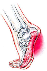 You can see how to get to stan's fit for your feet on our website. Plantar Fasciitis Stan S Fit For Your Feet