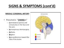 An overview of the current literature. Ischaemic Stroke Overview