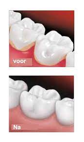 Maar hoe weet u nu of uw tandvlees gezond is? 10 Tips Tegen Ontstoken Tandvlees Leestip Slechte Adem Tips Tegen Slechte Adem Geur Top10 Middelen