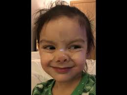 Child S Nose Is Broken Dad Fixes It Kinda Watch Her Reaction Full Length Youtube