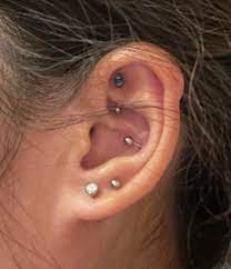 Help How To Treat Helix Piercing Scar Tissue I Took Out The Piercing 4 Months Ago Hard Bump Formed A Year Ago And Not Going Away Piercing