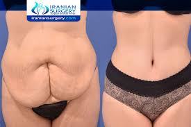 وسبب تسكين الألآم هو مادة الاكسيتوسين التي تفرز عند وصول المرأة للنشوة الجنسية. ØªØ¬Ø±Ø¨ØªÙ ÙØ¹ ÙØ­Øª Ø§ÙØ¬Ø³Ù Ø¨Ø§ÙÙÙØ²Ø± ØªØ¬Ø±Ø¨ØªÙ ÙØ¹ ÙØ­Øª Ø§ÙØ¬Ø³Ù Ø¨Ø§ÙÙÙØ²Ø± ØªØ¬Ø§Ø±Ø¨ÙÙ ÙØ¹ ÙØ­Øª Ø§ÙØ¬Ø³Ù Ø¨Ø§ÙÙÙØ²Ø±