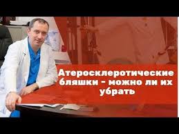 как почистить сосуды в домашних условиях быстро и эффективно Ateroskleroticheskie Blyashki Mozhno Li Ih Ubrat Youtube Zdorove Vrachi Medicina