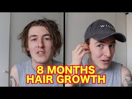 8 Months Hair Growth How To Wear A Hat With Long Hair Youtube