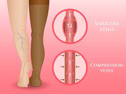 Can Wearing Compression Socks Be Harmful Mindbodypal